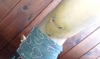 LOS VECINOS QUIEREN QUE SE RETIRE AL PERRO DEL BARRIO